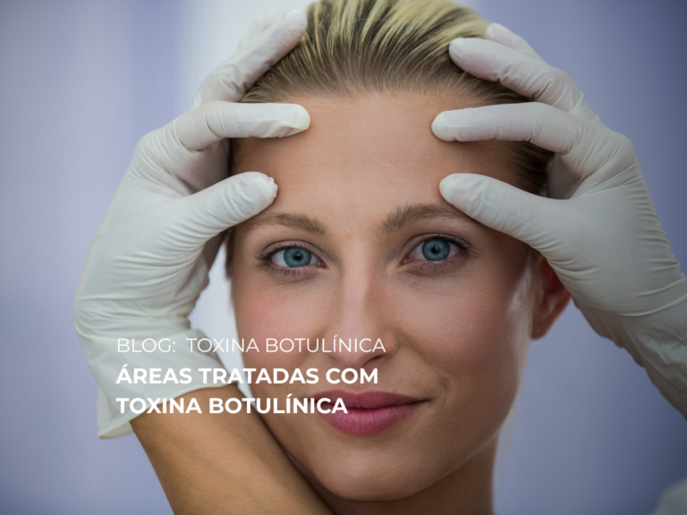Áreas Tratadas com Toxina Botulínica