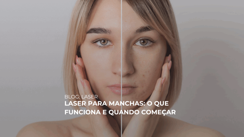LASER PARA MANCHAS