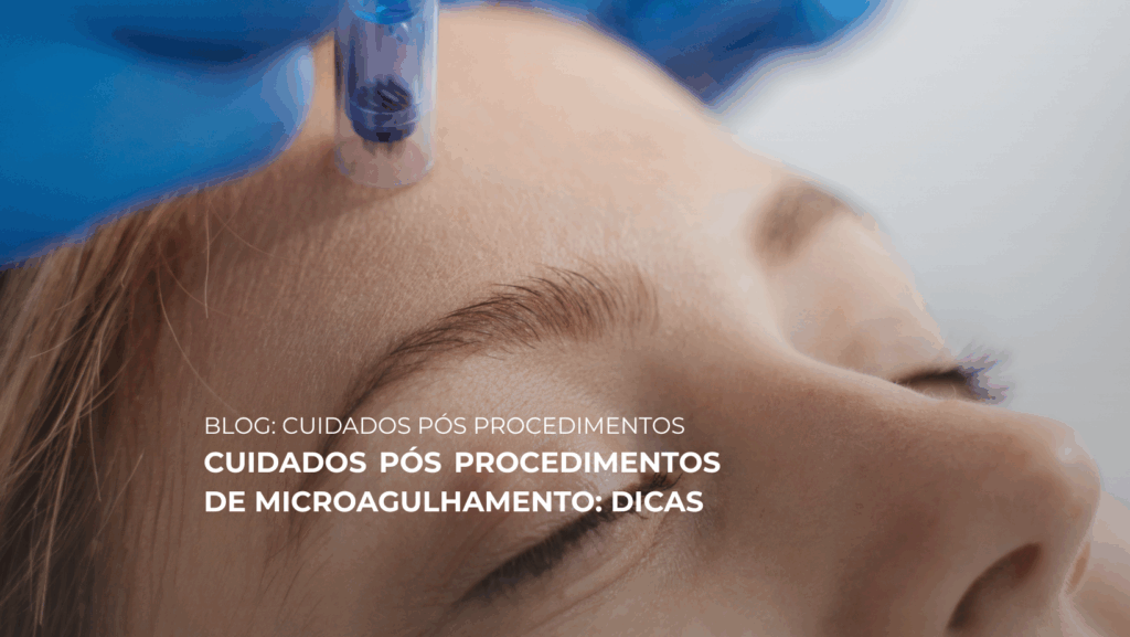 MICROAGULHAMENTO